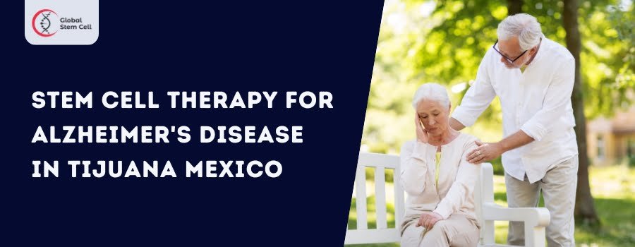 Stem Cell Therapy for Alzheimer's Disease in Tijuana Mexico