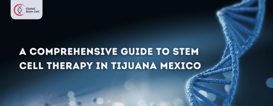 Stem Cell Therapy in Tijuana Mexico