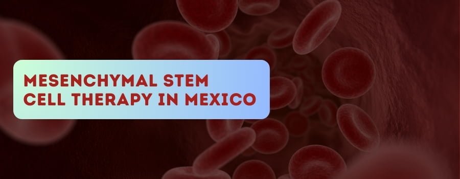Mesenchymal Stem Cell Therapy in Mexico
