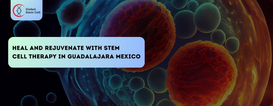 Stem Cell Therapy in Guadalajara Mexico