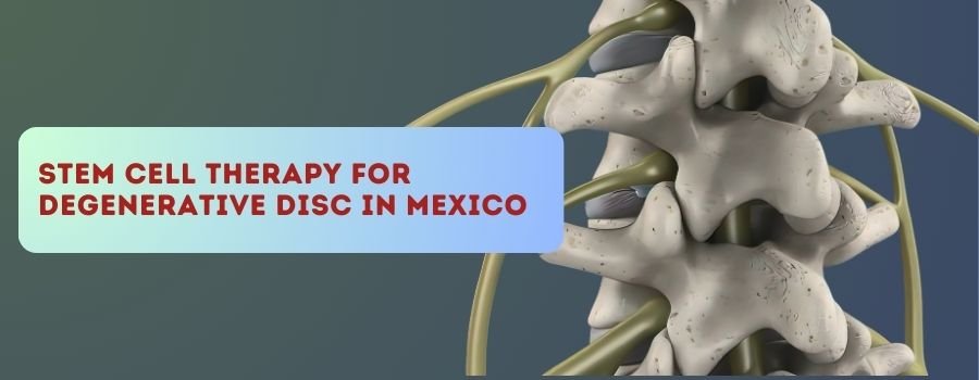 stem cell therapy for degenerative disc in mexico
