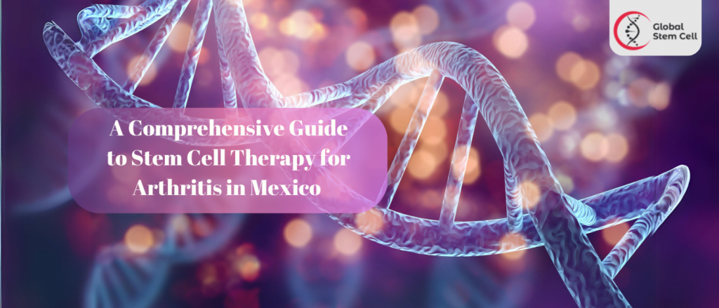 A Comprehensive Guide to Stem Cell Therapy for Arthritis in Mexico 