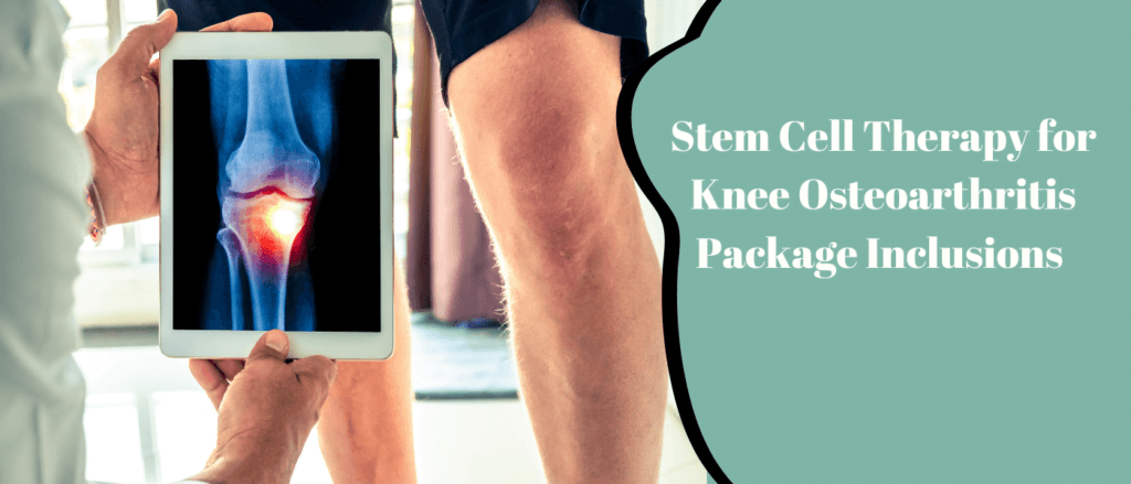 Stem Cell Therapy for
 Knee Osteoarthritis 
Package Inclusions 