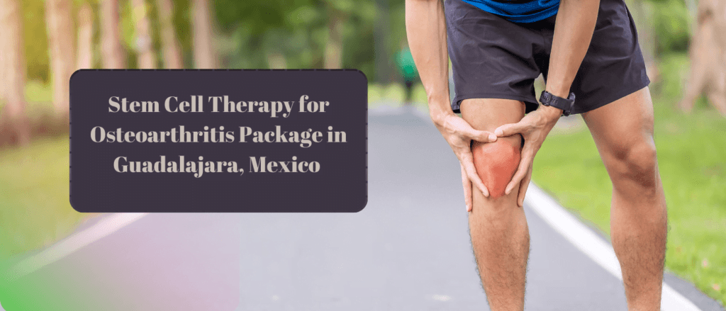 Stem Cell Therapy for Osteoarthritis Package in Guadalajara, Mexico