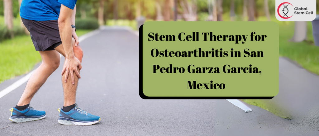 Stem Cell Therapy for Osteoarthritis in San Pedro Garza Garcia, Mexico 