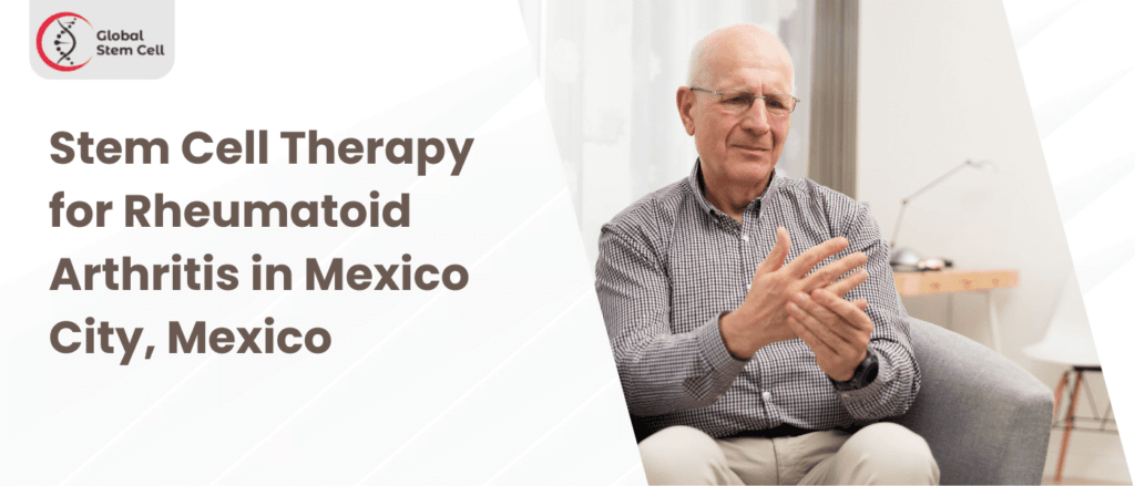 Stem Cell Therapy for Rheumatoid Arthritis in Mexico City, Mexico