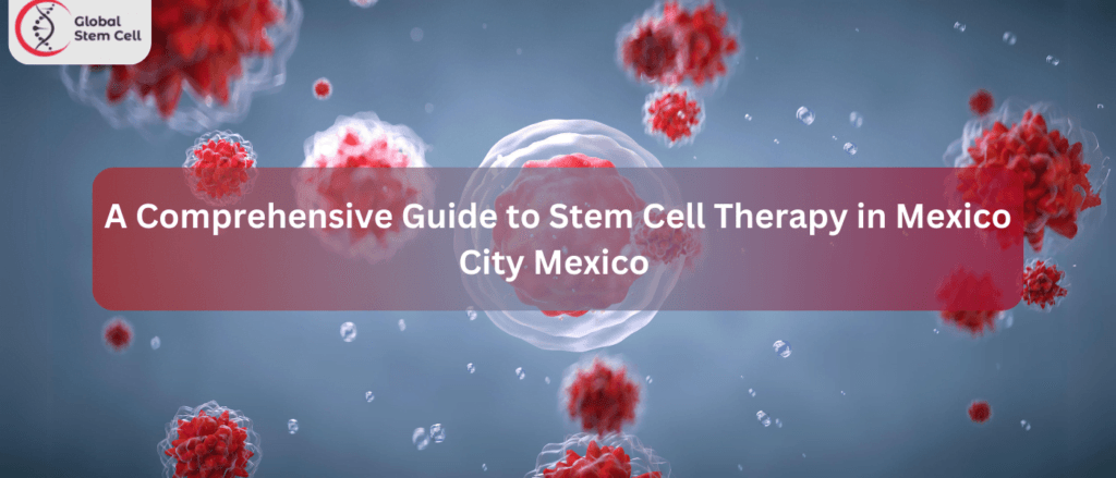 A Comprehensive Guide to Stem Cell Therapy in Mexico City Mexico 