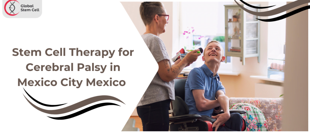 Stem Cell Therapy for Cerebral Palsy in Mexico City Mexico