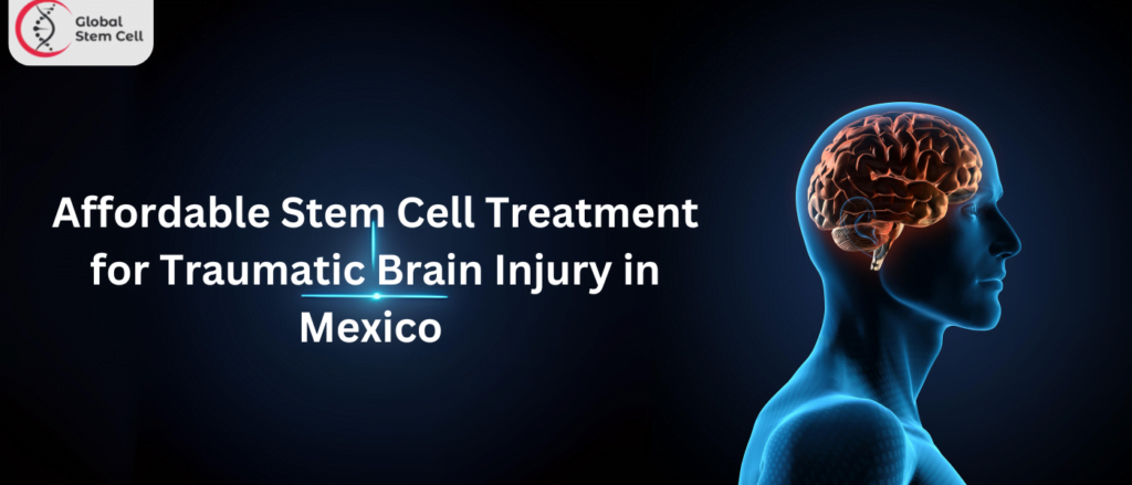 Affordable Stem Cell Treatment for Traumatic Brain Injury in Mexico