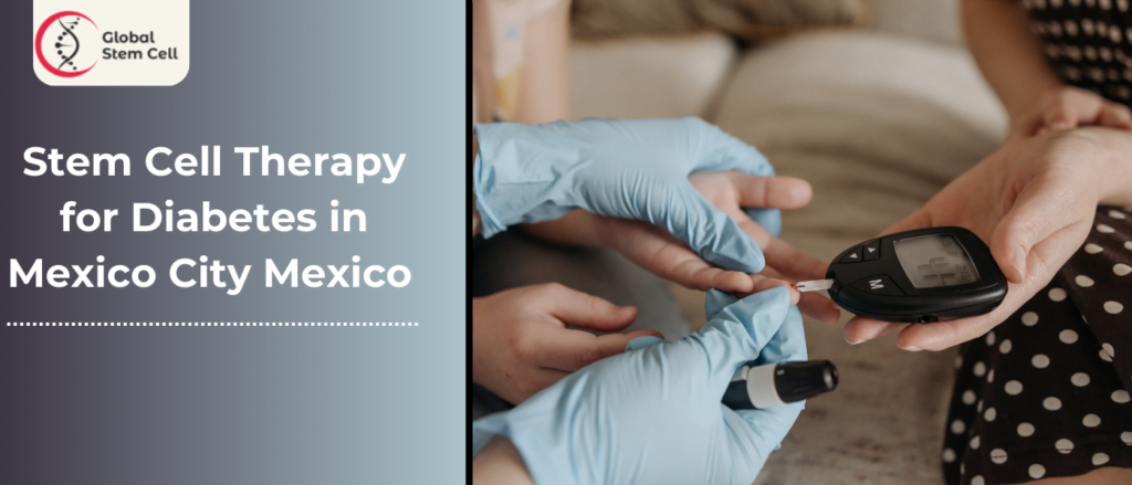 Stem Cell Therapy for Diabetes in Mexico City Mexico 