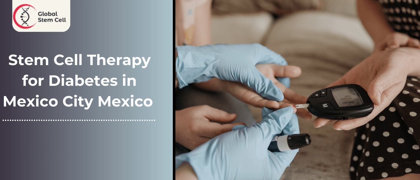 Stem Cell Therapy for Diabetes in Mexico City Mexico