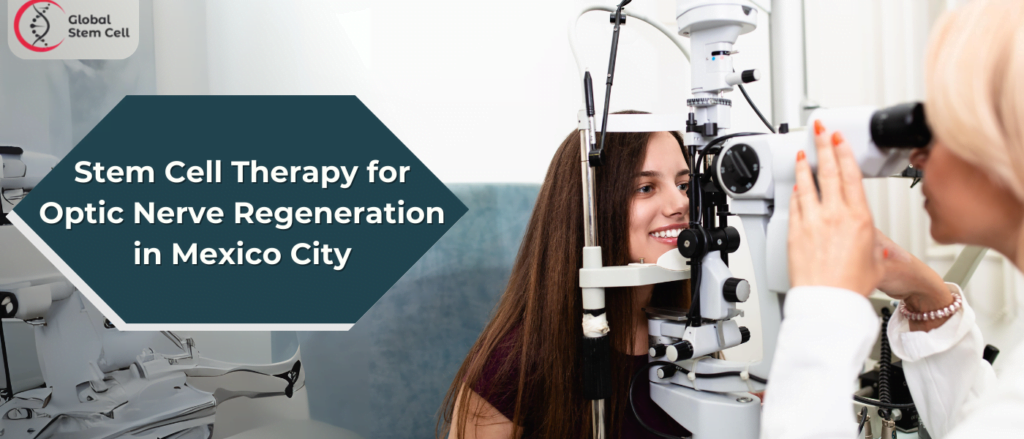 Stem Cell Therapy for Optic Nerve Regeneration in Mexico City