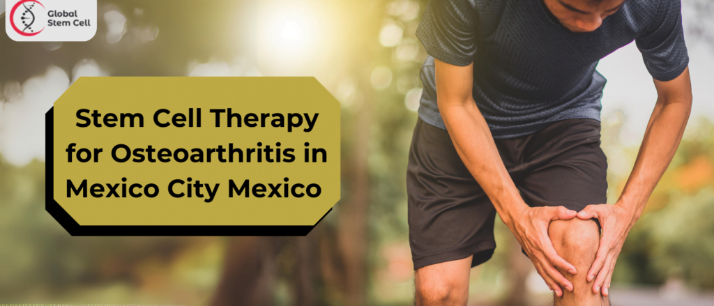 Stem Cell Therapy for Osteoarthritis in Mexico City Mexico