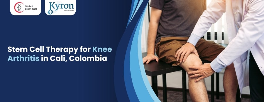 Stem Cell Therapy for Knee Arthritis in Cali Colombia