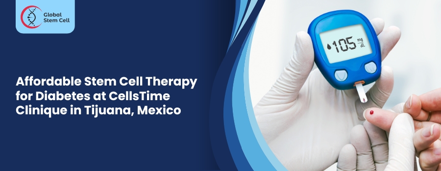 Affordable Stem Cell Therapy for Diabetes at CellsTime Clinique in Tijuana, Mexico