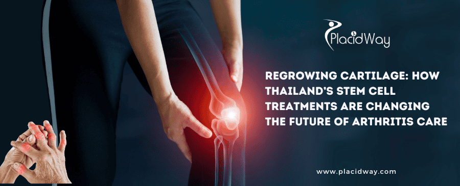 Discover Stem Cell Treatment for Arthritis in Thailand