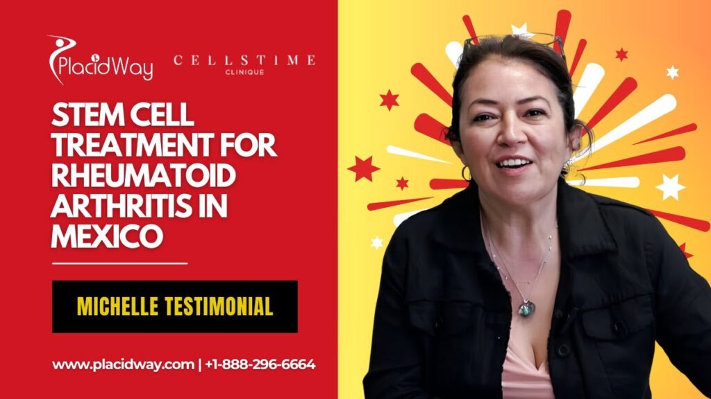 Stem Cell Treatment for Rheumatoid Arthritis in Tijuana Mexico