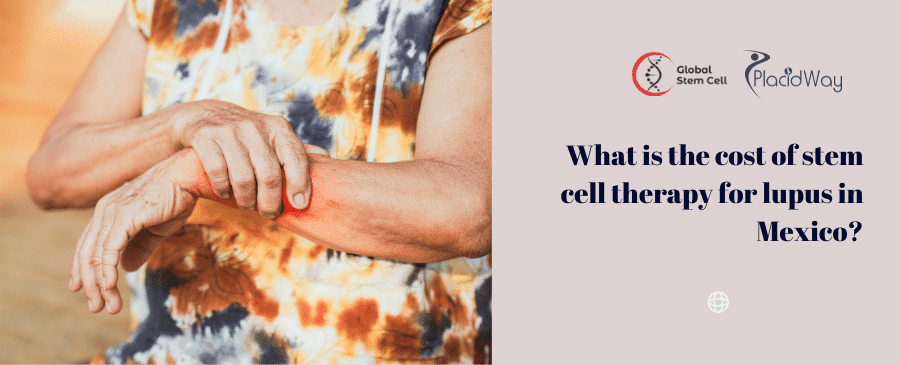 What is the cost of stem cell therapy for lupus in Mexico?