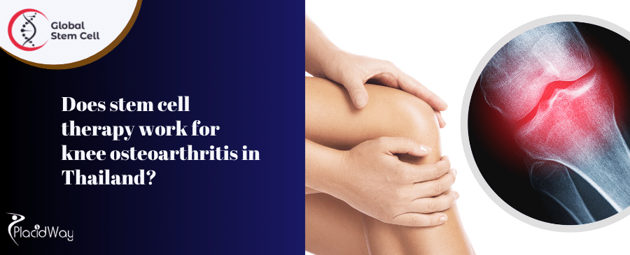 Does stem cell therapy work for knee osteoarthritis in Thailand