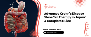 File 21 Advanced Crohns Disease Stem Cell Therapy in Japan: A Complete Guide
