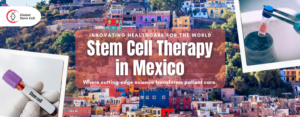 Stem Cell Therapy in Mexico