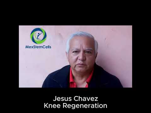 Hqdefault 62 The Full Process: Stem Cell Therapy for Knee Regeneration – A Mexico Guide