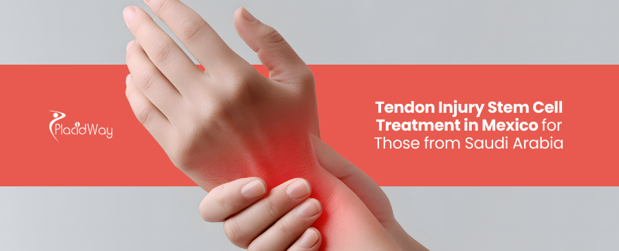 Tendon Injury Stem Cell Treatment in Mexico for Saudi Patients