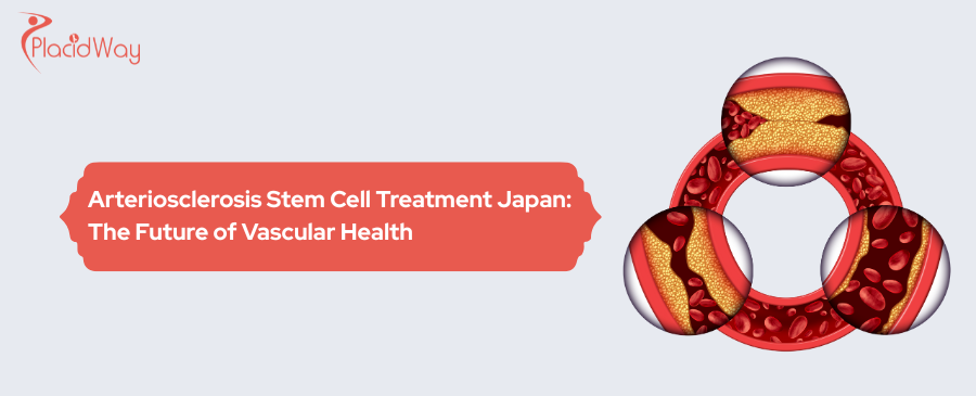 Arteriosclerosis Stem Cell Treatment in Japan: Guide 2025