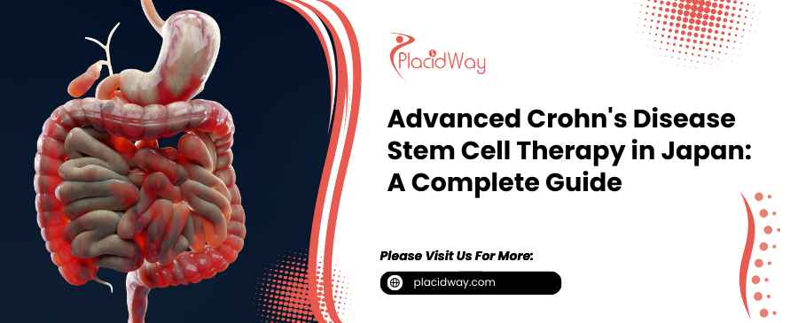 Can Advanced Crohn's Disease Stem Cell Therapy in Japan Transform Your Life?