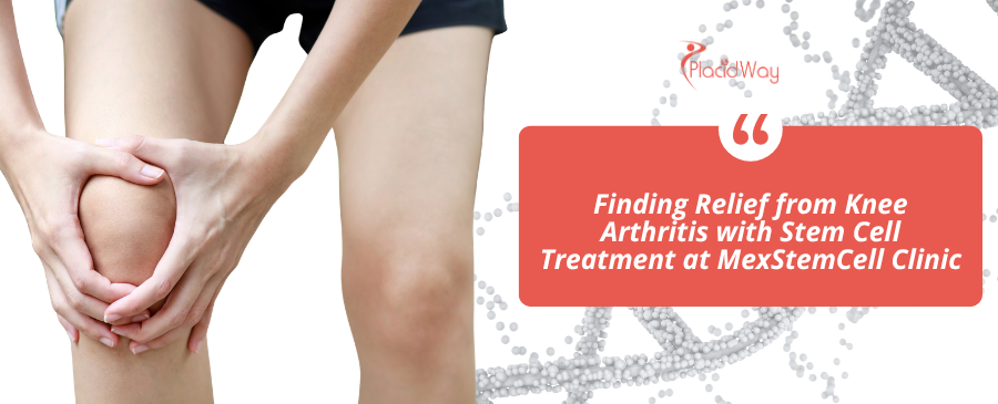How Does Stem Cell Treatment for Knee Arthritis in Mexico City Provide Affordable Relief?