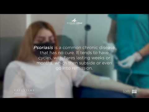 Hqdefault 35 Can Stem Cell Therapy Offer Long-Term Relief for Psoriasis? Advanced Regenerative Treatment in Mexico