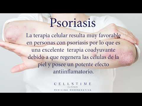 Hqdefault 37 A Patient-Friendly Guide to Undergoing Advanced Stem Cell Therapy for Psoriasis in Mexico
