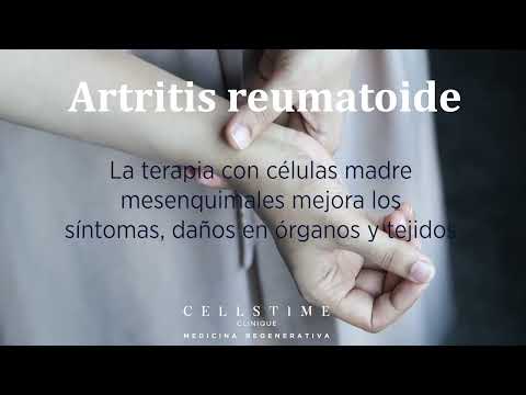 Hqdefault 39 Everything You Need to Know About Stem Cell Therapy for Rheumatoid Arthritis in Mexico