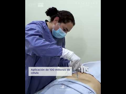 Hqdefault 73 Repairing Spinal Bone Erosion with Mesenchymal Stem Cell Treatment in Mexico