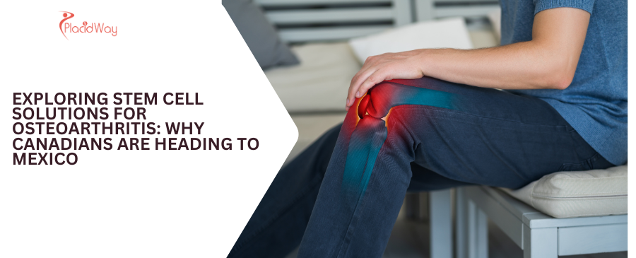 Stem Cell Therapy for Osteoarthritis: Canadians to Mexico