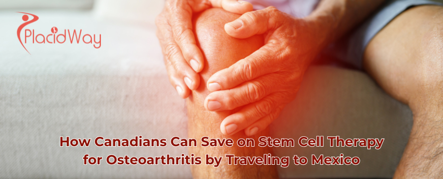 Save on Osteoarthritis Stem Cell Therapy in Mexico from Canada