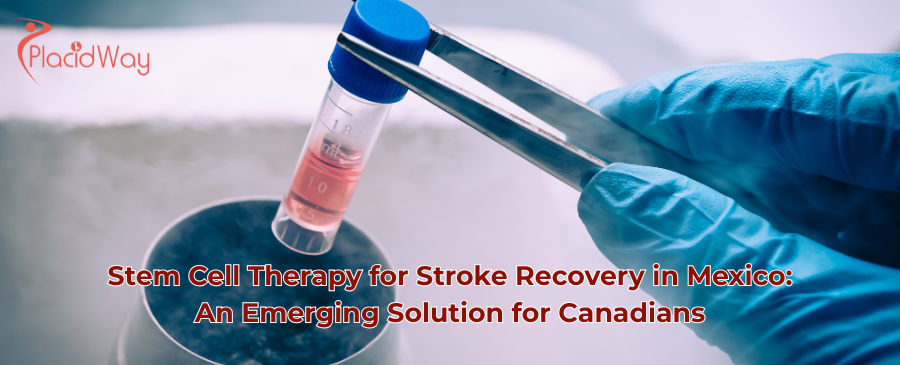 Stem Cell Therapy for Stroke in Mexico: Canadians' Guide