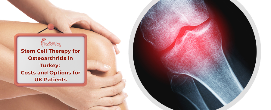 Stem Cell Therapy for Osteoarthritis in Turkey: Costs