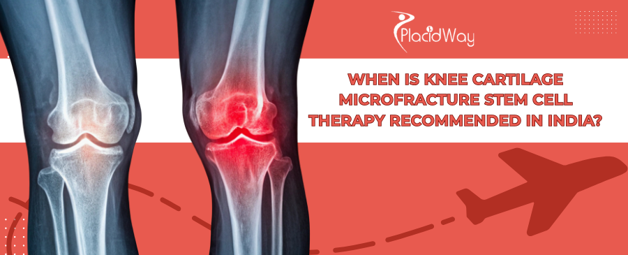 Knee Microfracture Stem Cell Therapy in India: When Is It Right?