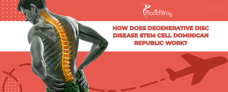 DDD Stem Cell Therapy DR: How it Works & Costs | PlacidWay