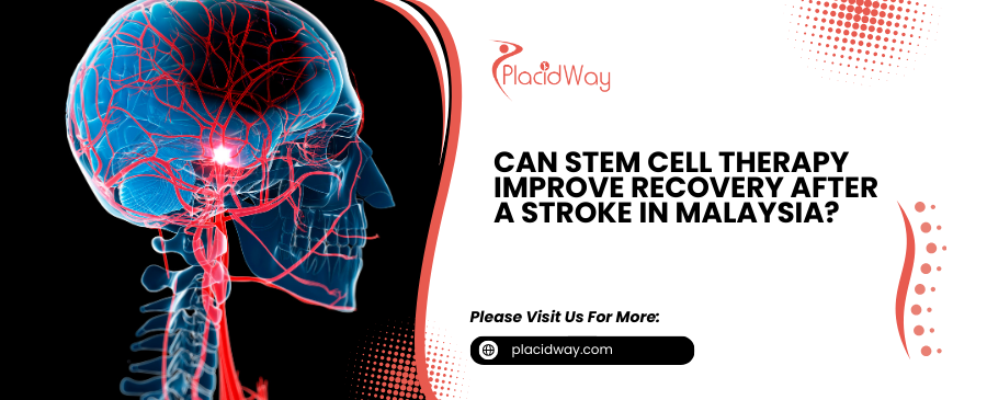 Stem Cell Therapy for Stroke Recovery in Malaysia: Expert Guide
