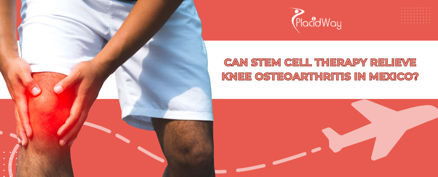 Knee Osteoarthritis: Stem Cell Therapy in Mexico