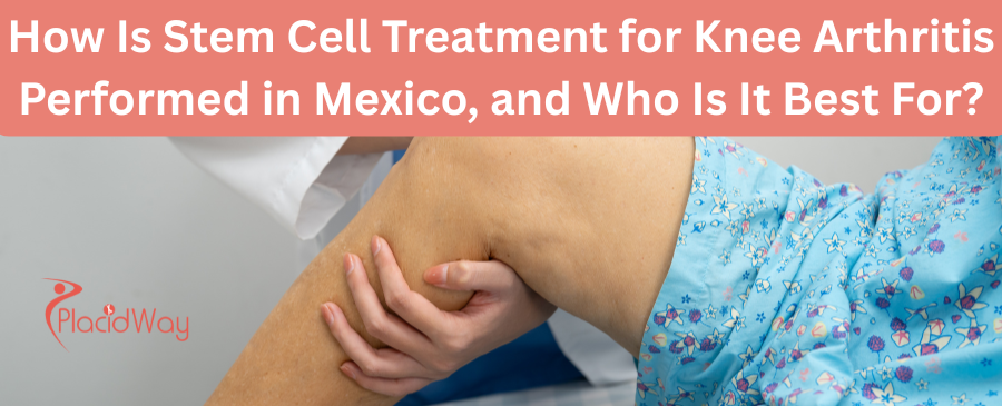 Stem Cell Treatment for Knee Arthritis in Mexico: Guide & Cost