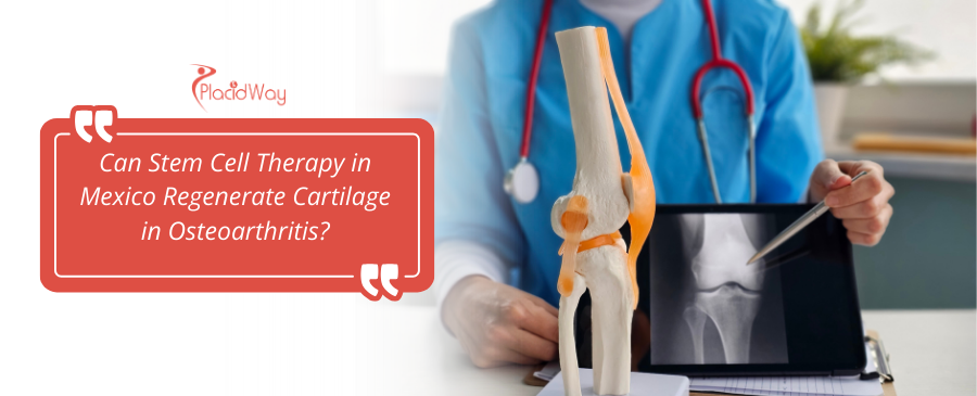Stem Cell Therapy in Mexico: Cartilage Regeneration for OA