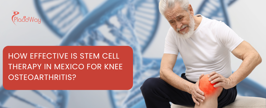 Stem Cell Therapy for Knee OA in Mexico: Effectiveness & Costs