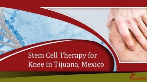 Stem cell therapy for knee in Tijuana Mexico