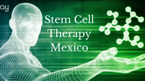 Stem Cell Therapy in Mexico