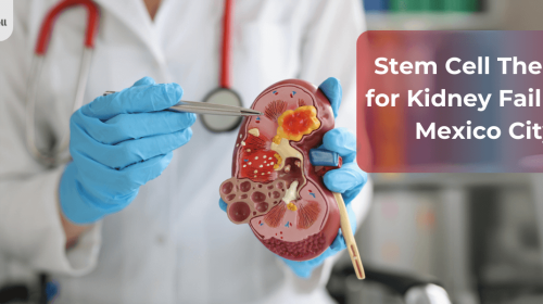 Stem Cell Therapy for Kidney Failure in Mexico City