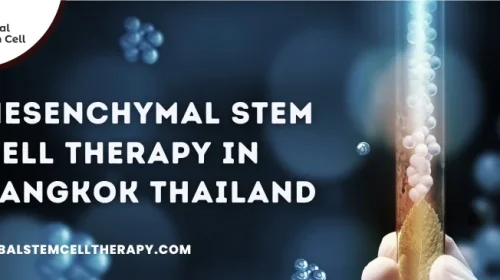 Mesenchymal Stem Cell Therapy in Bangkok Thailand