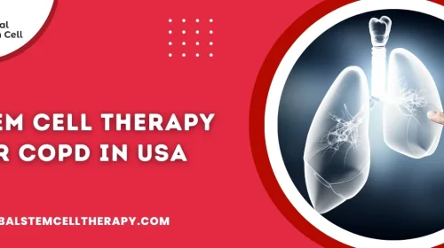 Stem Cell Therapy for COPD IN USA